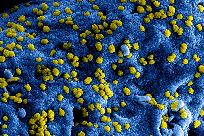 Vragen over het coronavirus en sport